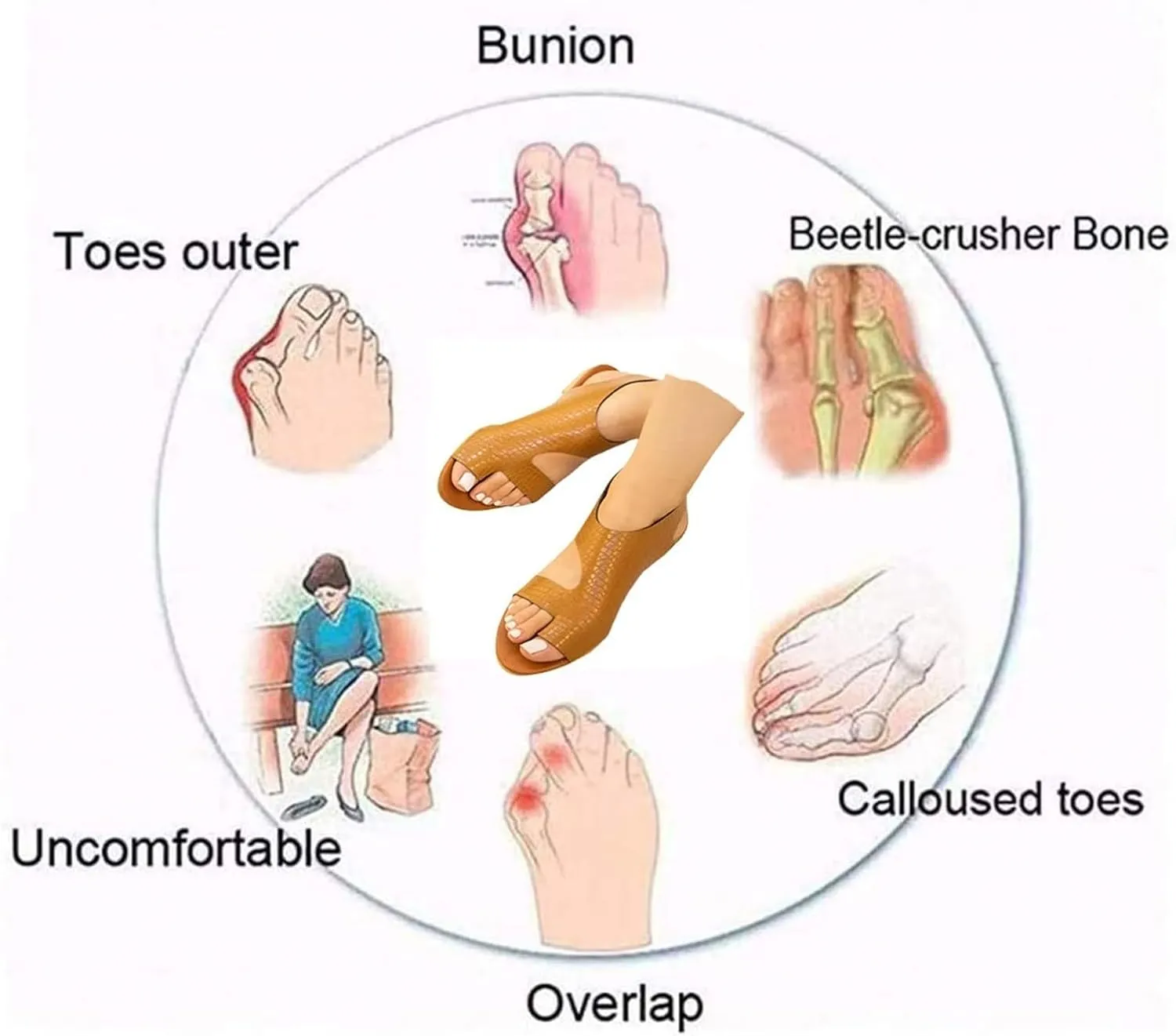 Women's Comfort Flat Sandals, Women Fashion Breathable Clip Toe Bunion Corrector Flat Shoes, Animal Print Crocodile Pattern Beach Travel Sandals, for Bunion Splints Toe Separator